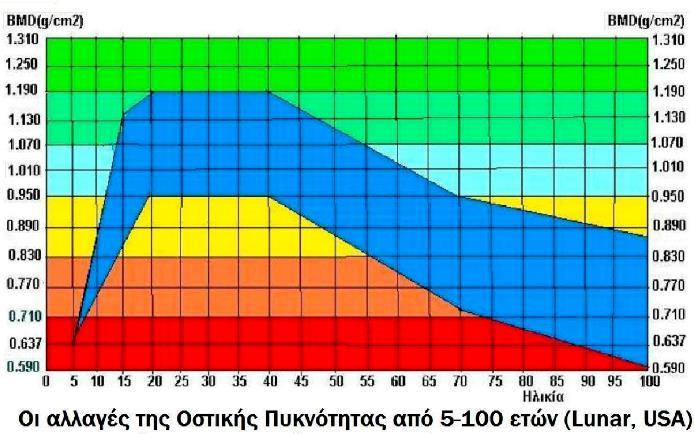 Η οστεοπόρωση είναι χρόνια πάθηση του μεταβολισμού των οστών, κατά την οποία παρατηρείται σταδιακή μείωση της πυκνότητας και της ποιότητάς τους, με αποτέλεσμα αυτά με την πάροδο του χρόνου να