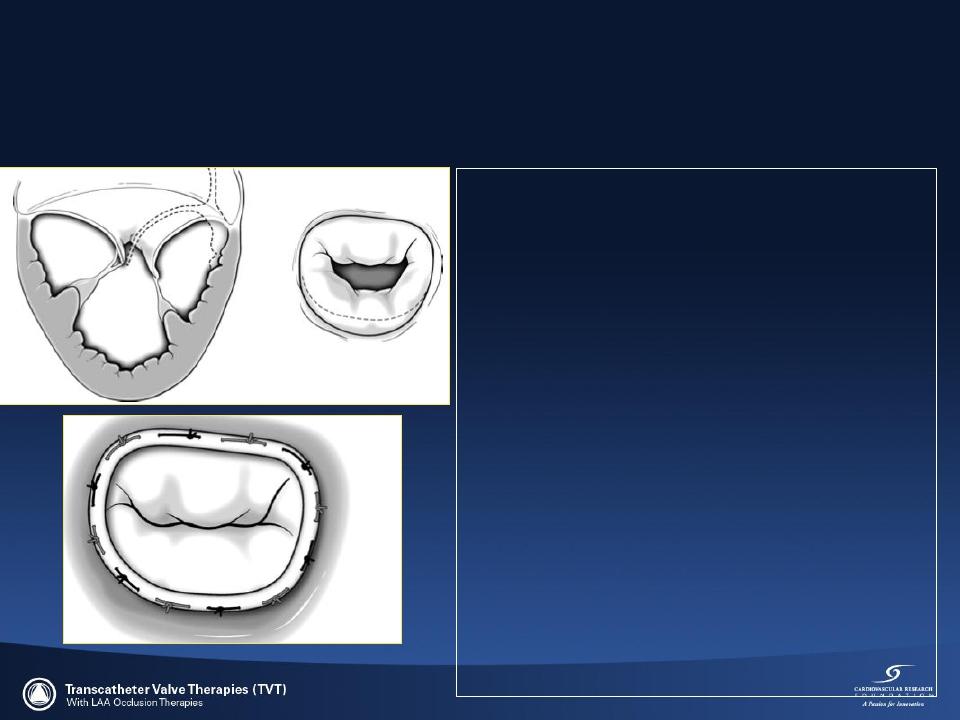 greatest in the septallateral (anterior-posterior)
