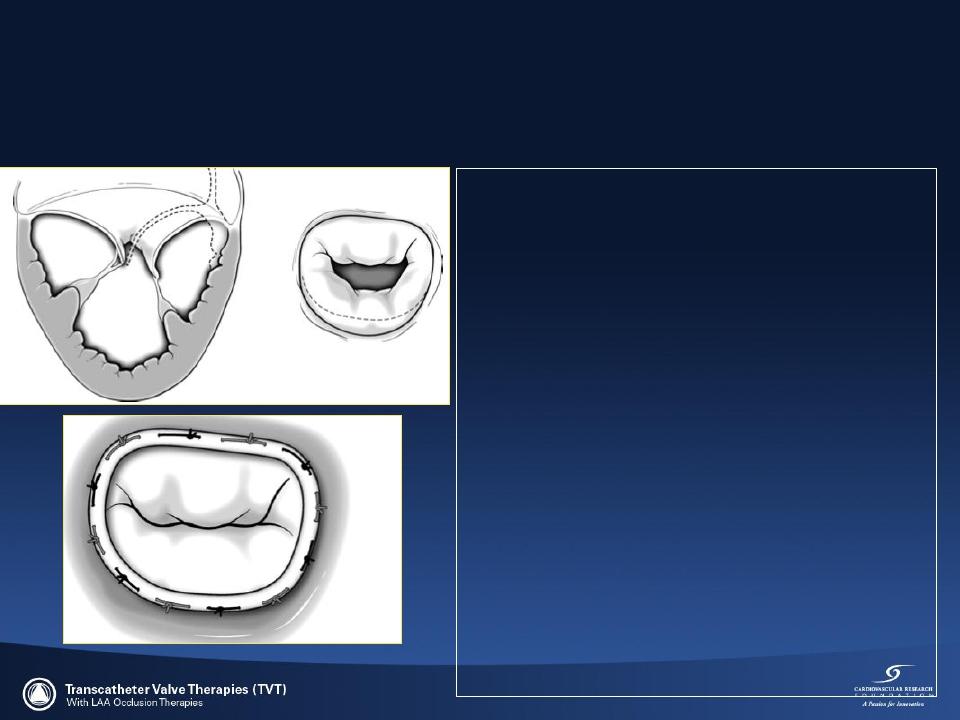 greatest in the septallateral (anterior-posterior)