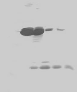 Μέθοδος ανοσοαπoτυπώματος (western blot) για τoν προσδιορισμό των προϊόντων της κοπής της πρωτεΐνης GST-ORF68-His 6 με τον παράγοντα Xa.