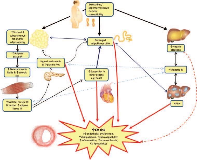 Non-alcoholic fatty liver disease: a new and important