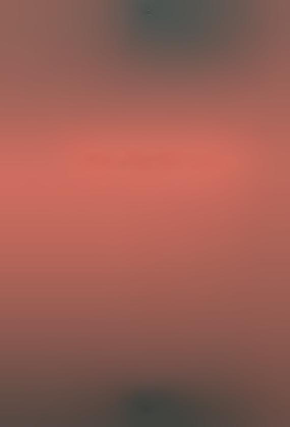 87