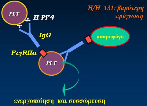 (ii) HIT-II ή ανοσολογική HIT: είναι όψιμη (5-15 ημέρες από την έναρξη της αγωγής, σπανίως και μετά τη συμπλήρωση της 2 ης εβδομάδας), μπορεί να είναι και άμεση (αν έχει προηγηθεί προσφάτως χορήγηση