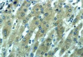 ANGIOGENESIS Closely related to biological behaviour and activity Immunohistochemical staining (brown) for