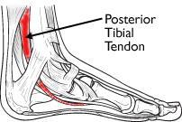 au/8183750/tibialis-anterior-tendonitis-tibialisanterior-t.