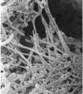 Γεωφυσική, ιζηµατολογική µελέτη Τηλεµετρική παρακολούθηση κρατήρων διαφυγής ρευστών σε σεισµικά ενεργές περιοχές ιδακτορική ιατριβή Εικόνα 2.3. Φωτογραφίες µεθανογενών archaea στο µικροσκόπιο.