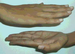ανάκλασης(m) Το δεξί χέρι ονομάζεται εναντιομορφική μορφή του δεξιού Ένας άλλος τελεστής που μετατρέει τα