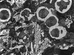 Εικόνα 15. Ελατός χυτοσίδηρος περλιτική μήτρα και σφαίρες γραφίτη. Μέσα στον περλίτη (σκούρα φάση) φαίνονται τα πρωτογενή καρβίδια του σεμεντίτη. Η φάση με τα λευκά γωνιακά σχήματα. 3%