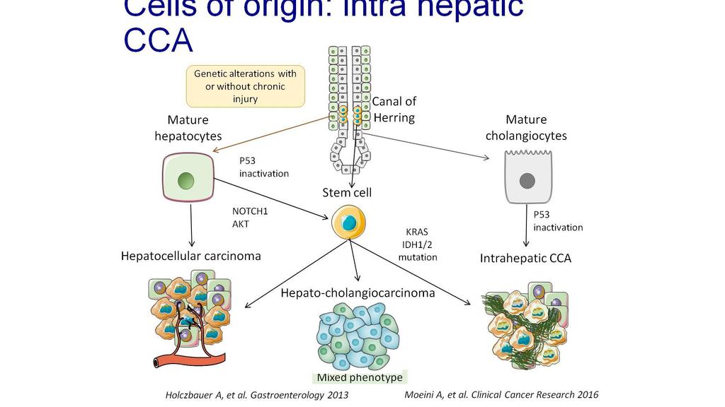 Προέλευση της νόσου Cells of origin: intra hepatic CCA