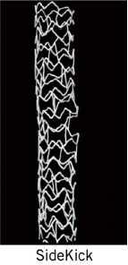 stenting are