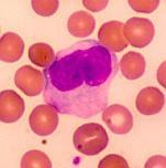 4. ΜΟΝΟΚΥΤΤΑΡΑ (Monocytes) 2-6 % των