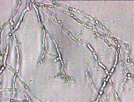 Εικόνα 4.3.2 Απεικόνιση των µυκηλιακών υφών µε κενοτόπια, κενών κυττάρων και εκφυλισµένων κυττάρων του B.