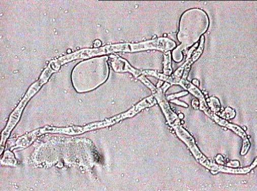 Εικόνα 4.3.6 Απεικόνιση των ζυγοσπορίων, των κενών κυττάρων και των εκφυλισµένων κυττάρων του B.