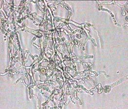 µήκους 50 µm). a: Μυκηλιακές υφές µε κενοτόπια, κενά κύτταρα και εκφυλισµένα κύτταρα του B.