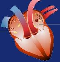 Atrial fibrillation consequences Loss of atrial systolic function (atrial contribution to ventricular filling is lost) Irregular rapid