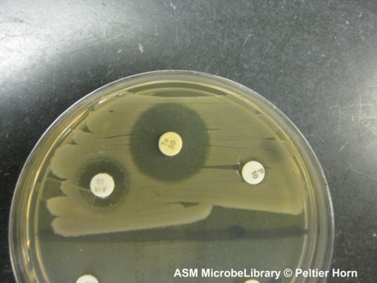 Escherichia coli 10 µg of ampicillin (AM 10), 30 µg