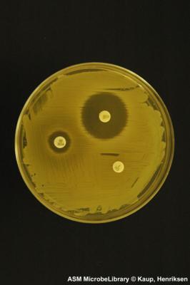 Staphylococcus aureus μειωμζνθ ευαιςκθςία ςε cefoxitin