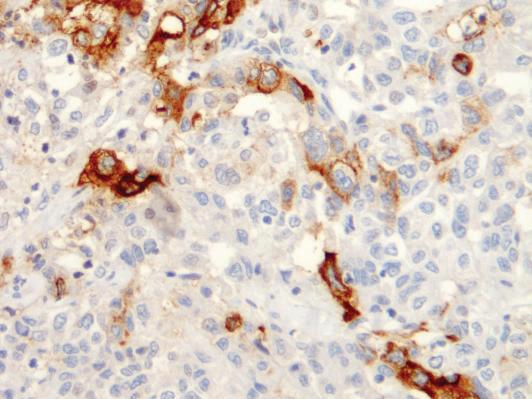 EpCam