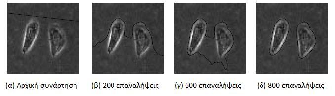 73 Εικόνα 25: Παράδειγμα εφαρμογής της μεθόδου LSWR σε εικόνα κυττάρων μικροσκοπίας. Οι τιμές των παραμέτρων είναι λ=5.0, μ=0.04, ν=1.5 και τ=5.0 [155].
