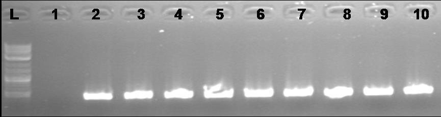 . L 1 2 3 4 5 6 7 8 9 10 11 12 13 1000bp Εικόνα 3.9. Ενδεικτικι εικόνα θλεκτροφόρθςθσ ςε πθκτι αγαρόηθσ 1 % των προϊόντων που προζκυψαν από PCR ενίςχυςθ του γονιδίου 16S rrna των ΑΟΒ του εδάφουσ με τουσ εκκινθτζσ βamof-βamor.