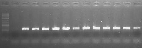 2% των προϊόντων που προζκυψαν από PCR εςωτερικισ ζνκεςθσ του γονιδίου 16S rrna των ΑΟΒ με τουσ εκκινθτζσ 357f+GC-534.