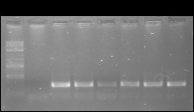 1000bp Εικόνα 4.4. Ενδεικτικι εικόνα θλεκτροφόρθςθσ ςε πθκτι αγαρόηθσ 1.2%, των PCR προϊόντων από τθν ενίςχυςθ τμιματοσ του γονιδίου 18S rrna των ΔΜΜ με τουσ εκκινθτζσ AML1-AML2.