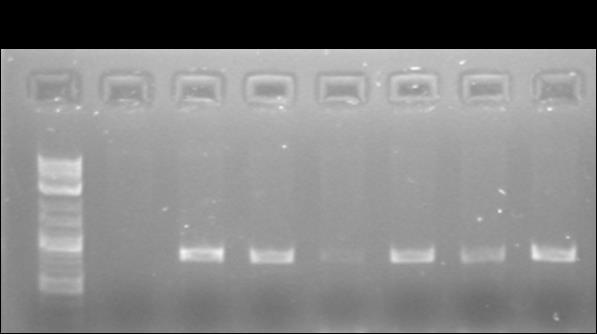 ε κάκε γραμμι φορτϊκθκαν 5μl προϊόντοσ PCR.