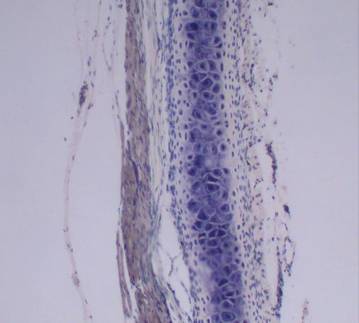 αγγεία και νεύρα για τη θρέψη του χόνδρου, καθώς και χονδροβλάστες, με δυνατότητα σχηματισμού νέου χόνδρου (απουσία περιχόνδριου στον αρθρικό χόνδρο) Οι χόνδροι διακρίνονται σε: υαλοειδείς