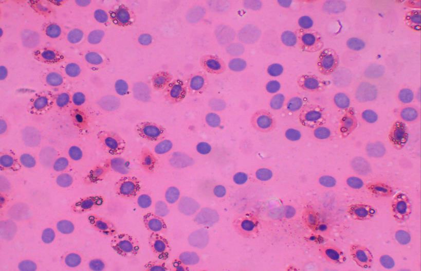 αιμοπετάλια η θρομβοκύτταρα) Λέμφος = κυκλοφορεί στα