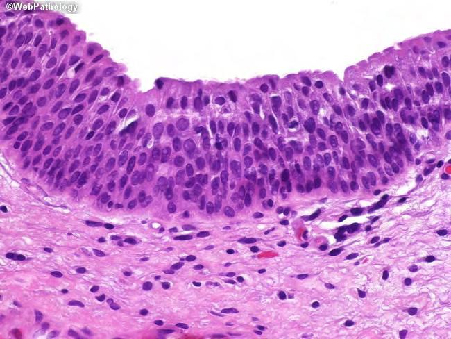 al, 1989, Truschel et al, 1999). υ α α φα υ α απ α φ α α. Η αυ π φ α π φα α υ α α απ α α π α υ α υ α π π υ π α π α π υ π υ απ α α.