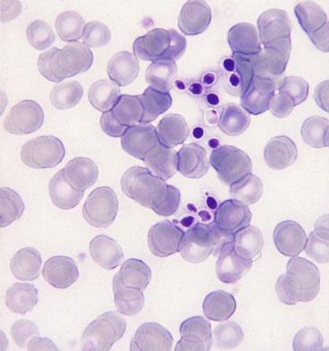 Blood film showing yeast forms of
