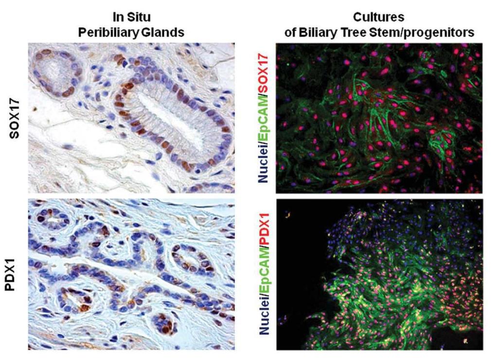 Έκφραση προγονικών δεικτών στους περιχολαγγειακούς αδένες Περιχολαγγειακοί αδένες Κυτταροκαλλιέργειες προγονικών