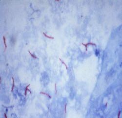 Mycobacterium tuberculosis ΕΝΔΕΙΚΤΙΚΗ ΌΧΙ ΑΠΟΔΕΙΚΤΙΚΗ Η ΤΑΧΕΙΑ ΧΡΩΣΗ Ziehl-Neelsen Kαλλιέργεια σε ειδικά εµπλουτισµένα θρεπτικά υλικά