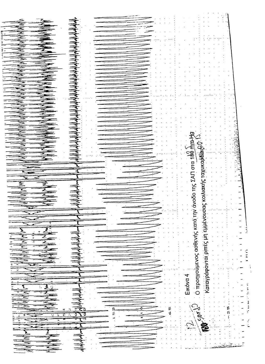 ο > ο * 111 α * U' 'CT >U)