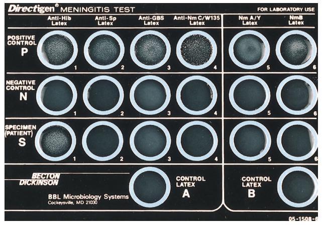 Ανίχνευση Ags με συγκόλληση latex DirectigenTM Meningitis Combo Test Ανίχνευση