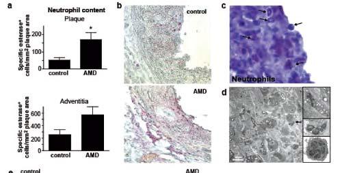 Protective Role of CXC Receptor 4/CXC Ligand 12 Unveils the