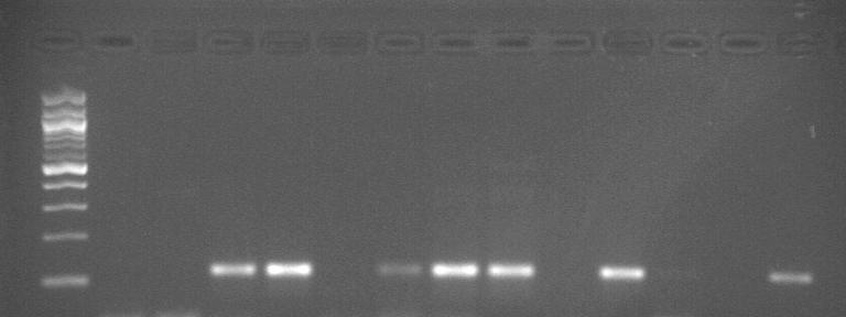 Θέσεις 3 έως 8: 10-2000R, 10-2000P, 11-2000R, 12-2000P, 12-2000K, 12-2000PS 1 2 3 4 5 6 7 8 9 10 11 12 13 14 Εικόνα 17: Ηλεκτροφόρηση