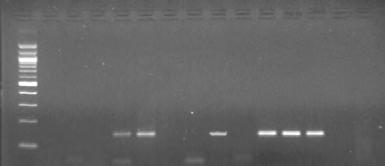 Θέσεις 3 έως 8: 10-2000K, 10-2000PS, 11-2000P, 11-2000K, 11-2000PS, 12-2000R Εικόνα 23: Ηλεκτροφόρηση προϊόντων της