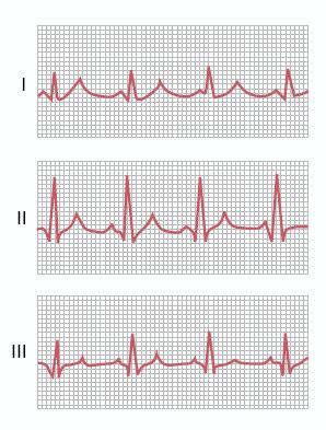 ΑΠΑΓΩΓΕΣ ΤΩΝ ΑΚΡΩΝ avr