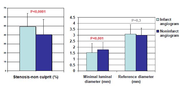 Non-culprit Lesion Exaggeration in