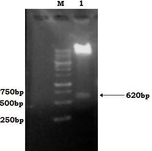 Τόσο το τμήμα DNA που απομονώθηκε όσο και o πλασμιδιακός φορέας pegfp C1, επωάστηκαν αρχικά με το ένζυμο περιορισμού KpnI. To τμήμα DNA καθαρίστηκε με το PCR Purification Kit (παράγραφοs B.2.7.