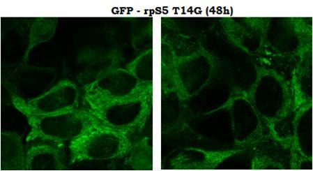 Τσιτουρούδη) Παρατηρείται ότι GFP (A) είναι διάχυτη στον πυρήνα και το κυτταρόπλασμα. Η μετάλλαξη της Τhr με το ουδέτερο αμινοξύ Gly παρουσιάζει διαφορετική συμπεριφορά από την αγρίου τύπου.