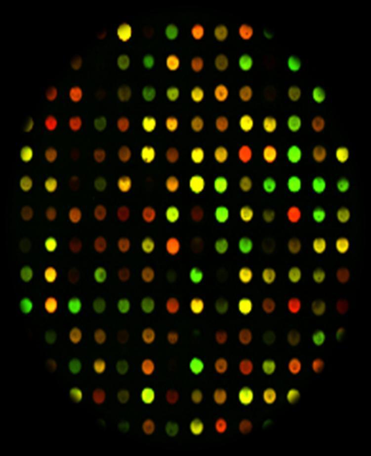 Microarrays Η ένταση του σήματος εκφράζεται