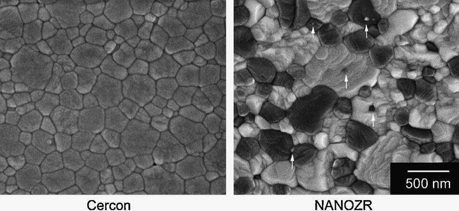 Σύνθετα νανόκοκκα κεραμικά: Τα κεραμικά αυτά αποτελούνται από μήτρα νανόκοκκης ζιρκονίας σταθεροποιημένης με οξείδιο του δημητρίου μέσα στην οποία βρίσκονται σε διασπορά νανόκοκκα μόρια δεύτερου