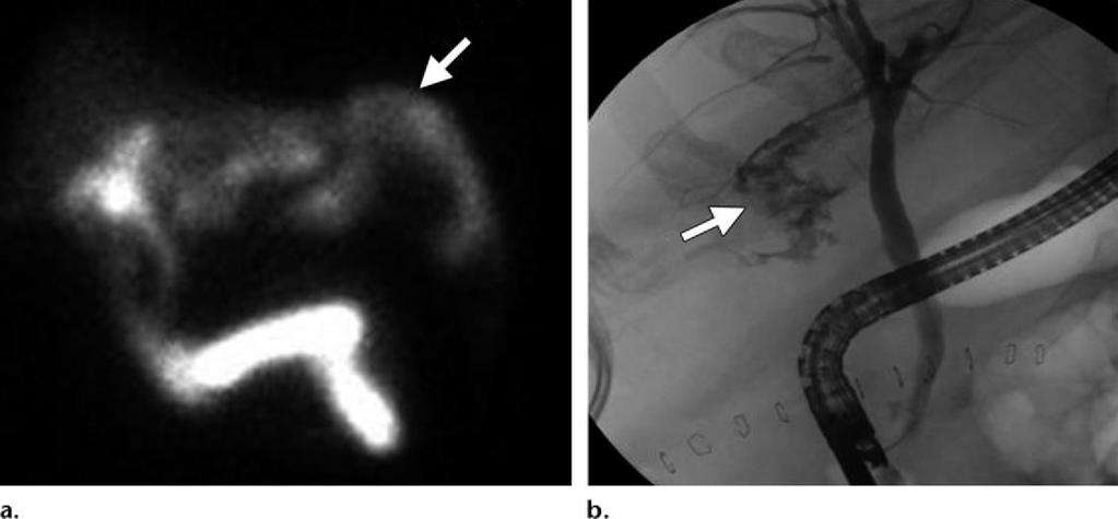 ERCP ΑΠΕΙΚΟΝΙΣΤΙΚΗ ΔΙΑΓΝΩΣΤΙΚΗ