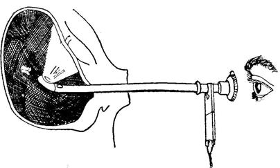 Pentru examinarea laringelui se introduce în gură aşanumita oglindă laringoscopică (Fig. 7), aflată la capătul unei tije metalice. Fig.