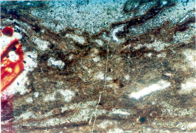 Εύρος οπτικού πεδίου 0.4 mm. Φωτογραφία 5.