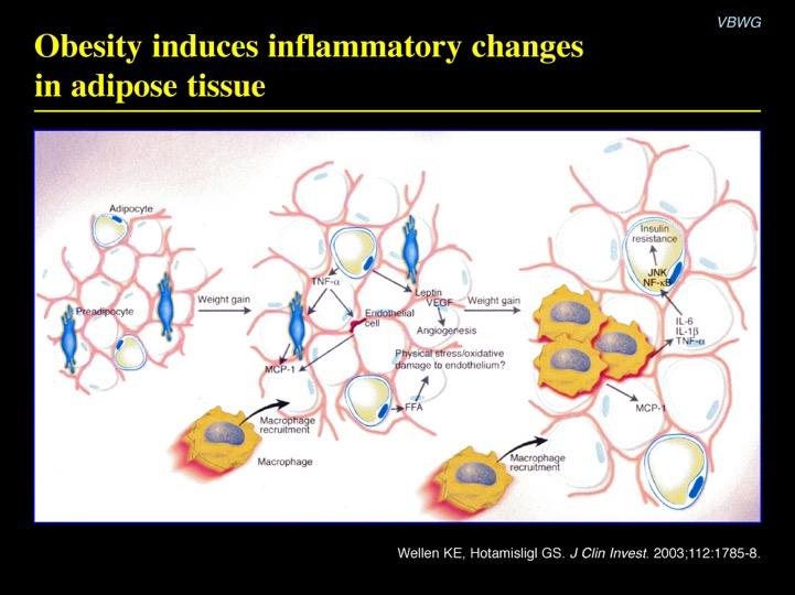Η αύξηση του λιπώδη ιστού πυροδοτεί φλεγµονώδεις αντιδράσεις και
