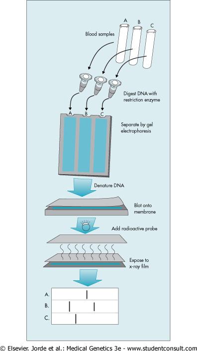 Σχήμα 3.13. Η διαδικασία RFLP. Το DNA εξάγεται από τα δείγματα αίματος των εξεταζόμενων Α, Β, και Γ. Το DNA διασπάται με ένζυμο περιορισμού και φορτώνεται ακολούθως σε ένα πήκτωμα.
