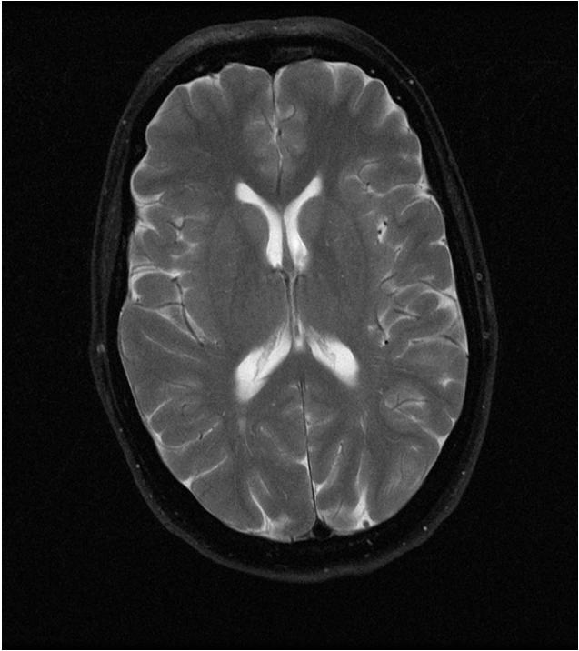 Παράδειγµα FT σε εικόνα MRI DC u
